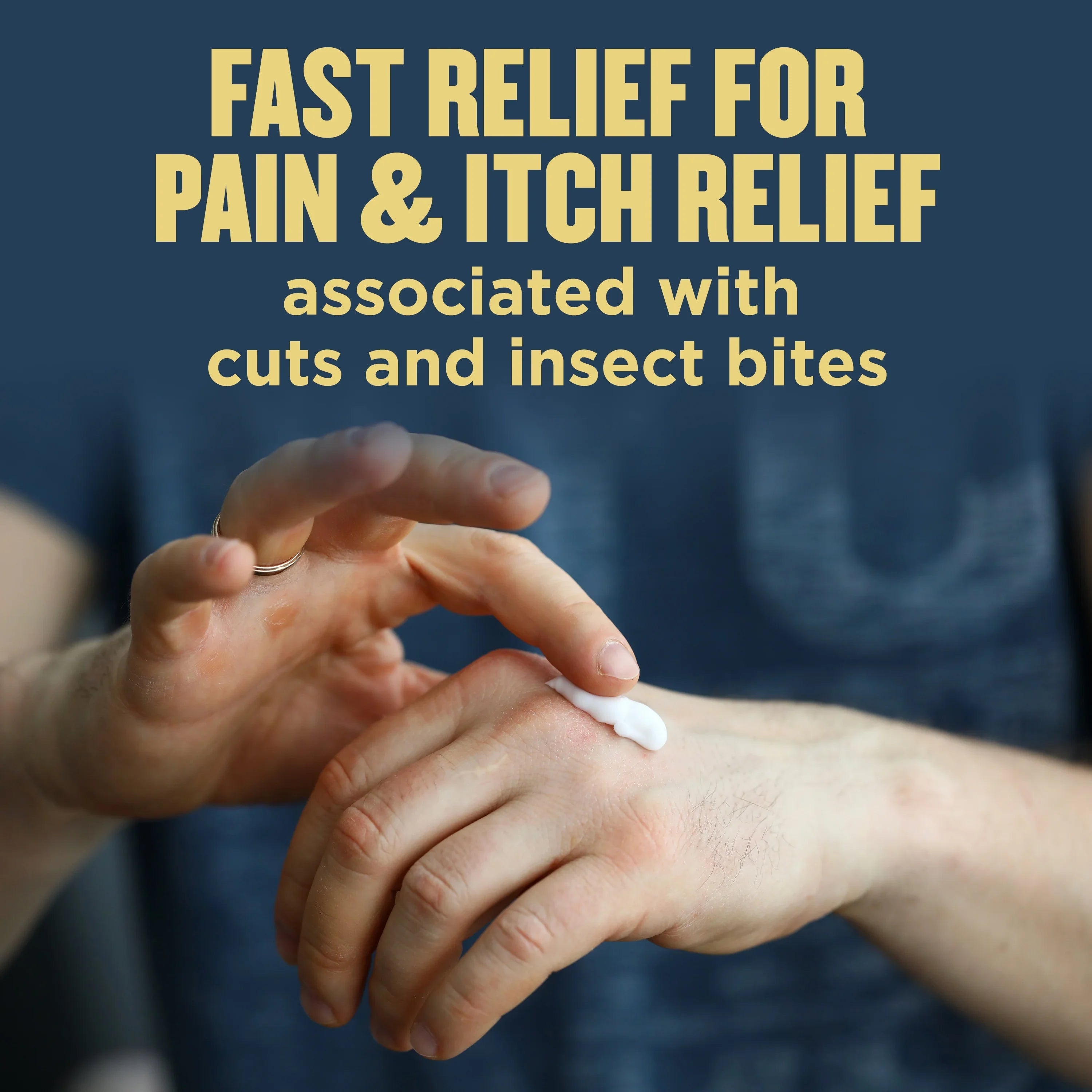 Gold Bond Anti-Itch Lotion 5.50 oz (Pack of 3)